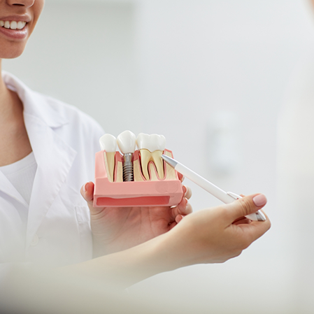 Dentist showing a patient a model of a dental implant