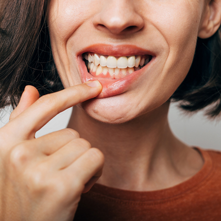 Woman pointing to a red spot in her gums