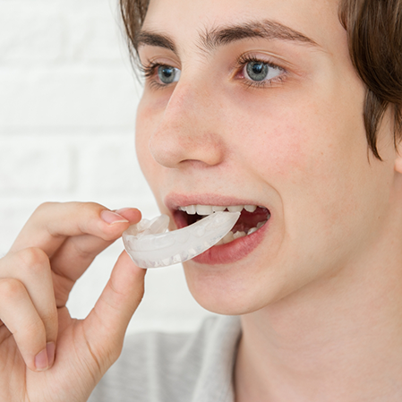 Person placing a white nightguard over their teeth